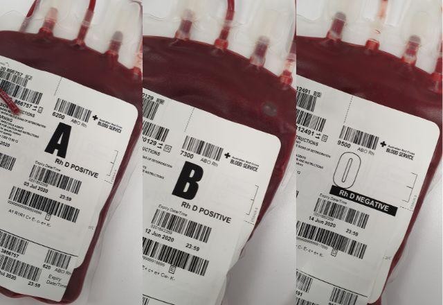 Imagem da noticia Após 40 anos, cientistas descobrem um novo tipo de sangue humano