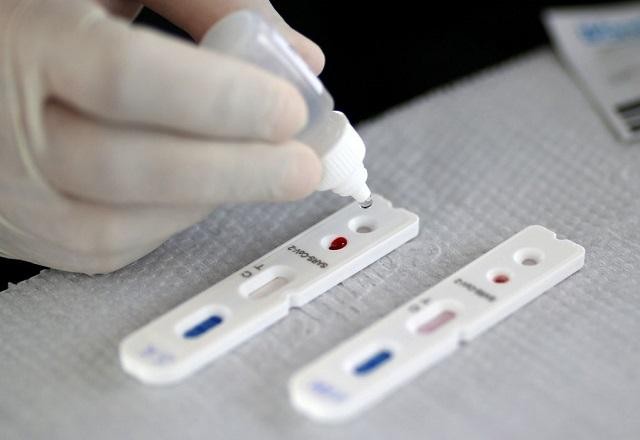 Imagem da noticia Doria determina que Procon-SP fiscalize preços de testes de covid-19