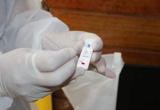 Imagem da noticia Covid-19: Brasil registra mais 65.165 casos e 1.857 mortes em 24 horas