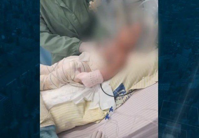 Imagem da noticia RJ: pais da bebê que sofreu graves queimaduras em hospital prestam depoimento