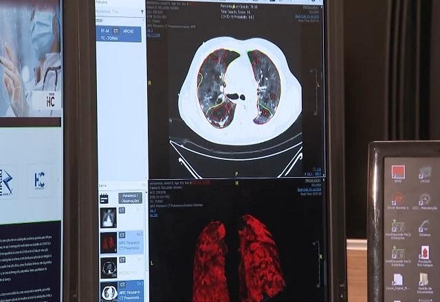 Imagem da noticia Internações por embolia pulmonar tem aumento de 40% no Brasil