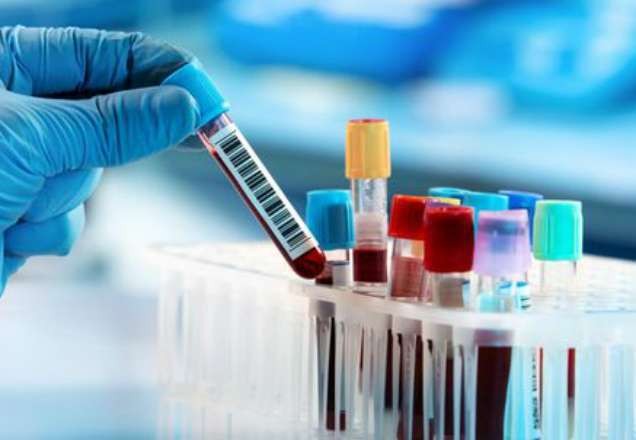 Imagem da noticia SBT Brasil mostra como se prevenir do novo coronavírus