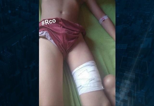 Imagem da noticia Menino de 11 anos é ferido por tubarão no litoral de SP