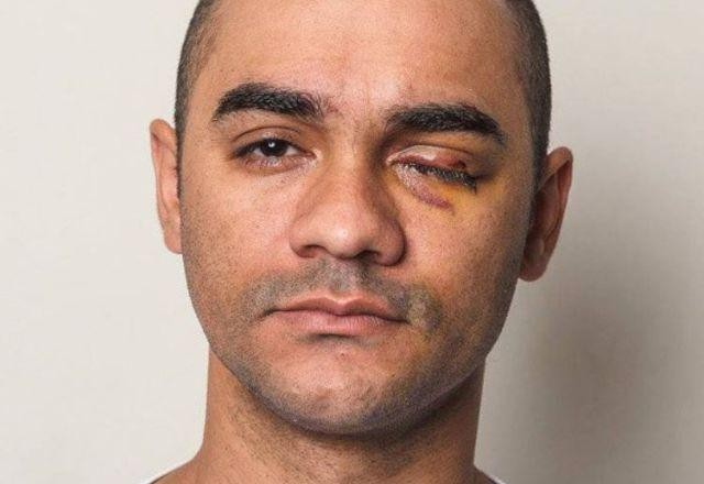 Imagem da noticia SP: Justiça nega indenização a fotógrafo baleado no olho em protesto de 2013
