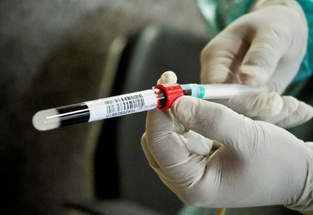 Imagem da noticia DF confirma 1ª morte de funcionário em hospital com surto de Delta