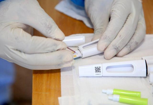 Imagem da noticia Brasil realiza mais de 8 mil testes de varíola dos macacos