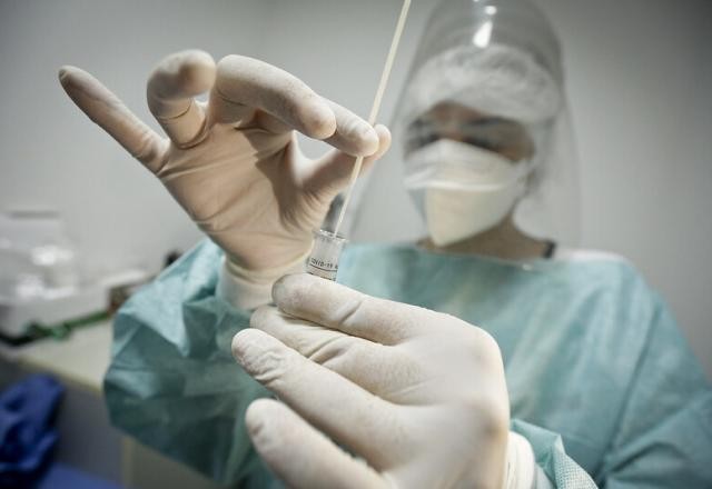 Imagem da noticia Covid: associação recomenda que testes só sejam feitos em pacientes graves
