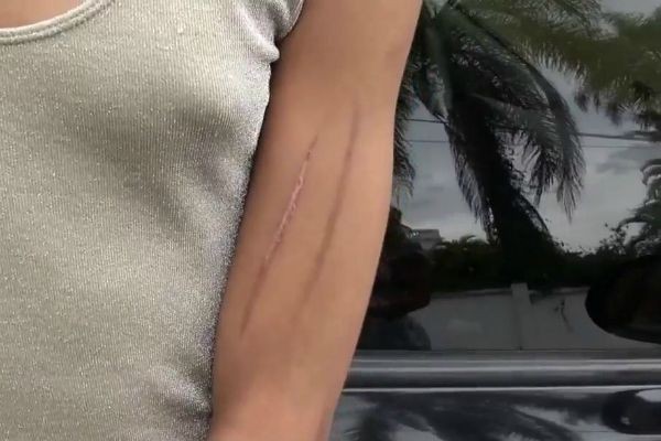Imagem da noticia Travestis denunciam policiais militares por agressões na Zona Sul de SP