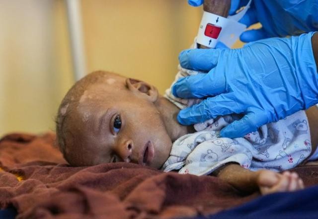 Imagem da noticia Unicef alerta para possibilidade de "explosão" de mortes de crianças na África