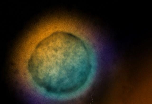 Imagem da noticia Nipah: Índia monitora surto de vírus mortal após registro de 5 infecções no país