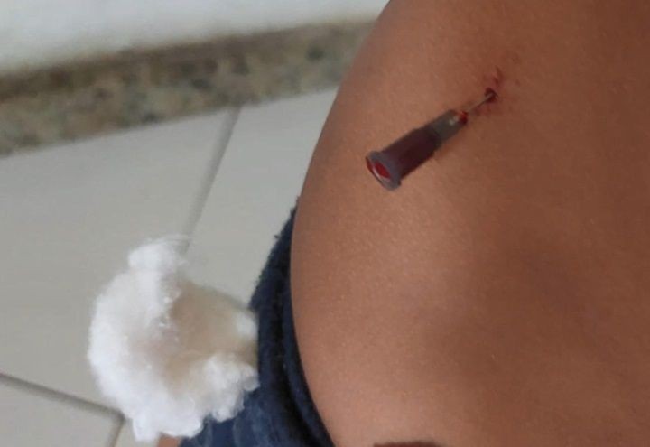 Imagem da noticia Família denuncia que agulha foi esquecida no corpo de criança 