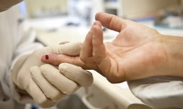 Imagem da noticia Uma pessoa morre por minuto no mundo por complicações da aids, diz ONU