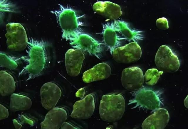 Imagem da noticia "Ameba comedora de cérebro" pode ser causa da morte de criança nos EUA