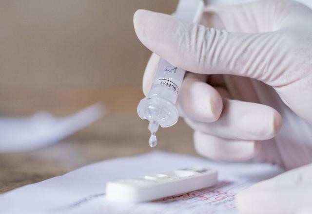 Imagem da noticia Anvisa aprova primeiro autoteste de covid-19 no Brasil