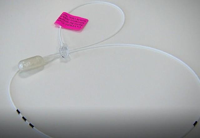 Imagem da noticia Novo balão gástrico é alternativa não-invasiva para quem quer emagrecer
