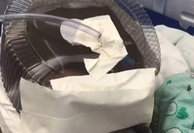 Imagem da noticia Bebê que usou embalagem de bolo como máscara de oxigênio improvisada morre em Natal