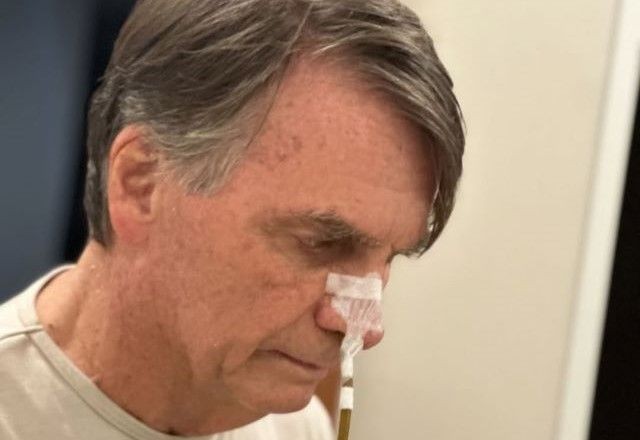Imagem da noticia Após endoscopia, Bolsonaro volta para o quarto