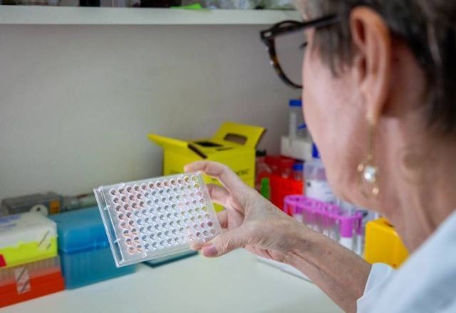 Imagem da noticia Instituto Butantan desenvolve diagnóstico capaz de detectar leptospirose no início