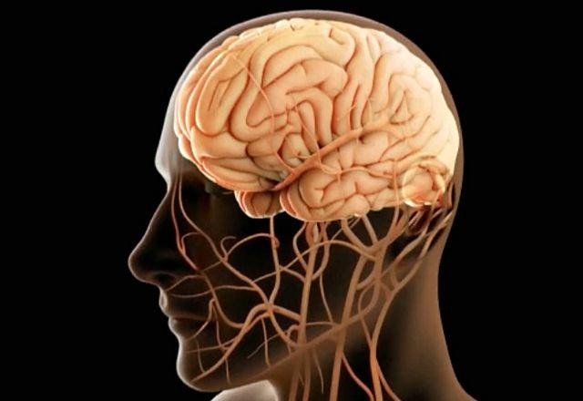 Imagem da noticia Cérebro protegido: como a cirurgia dos vasos previne derrame e salva vidas