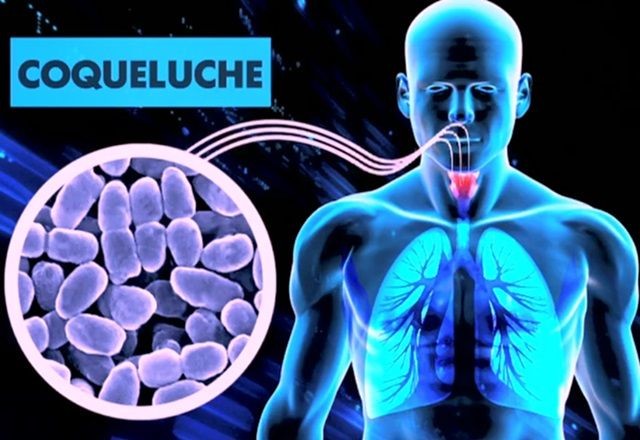 Imagem da noticia Cidade de São Paulo registra aumento nos casos de coqueluche em 2024