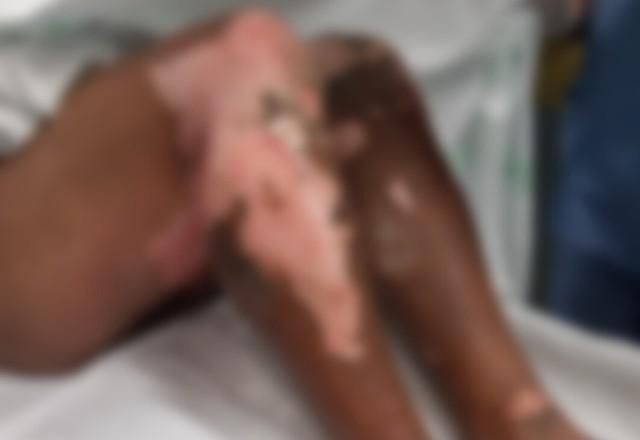 Imagem da noticia Criminosos ateiam fogo no corpo de turista em Florianópolis