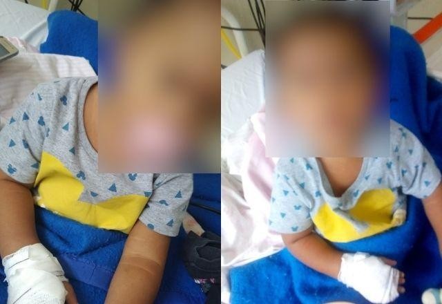 Imagem da noticia Bebê perde parte do dedo após erro médico, no Rio