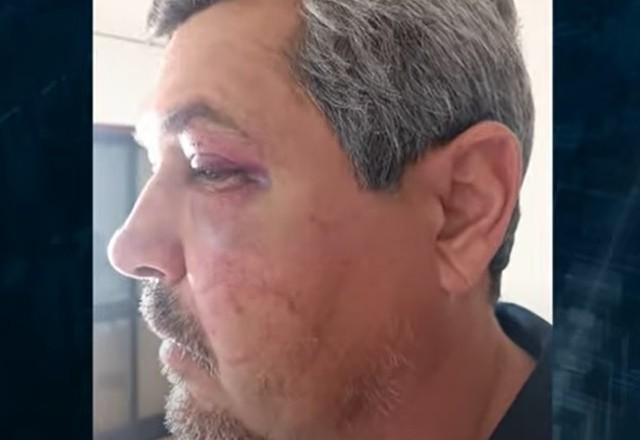 Imagem da noticia Engenheiro brasileiro é brutalmente agredido em Portugal
