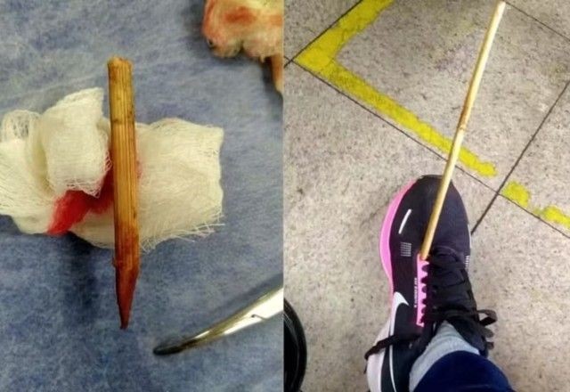 Imagem da noticia Mulher é atingida por flecha no centro de Belo Horizonte e vai parar no hospital