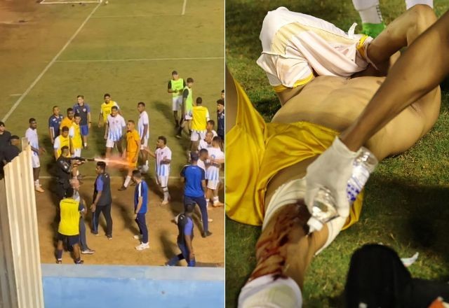 Imagem da noticia Goleiro do Grêmio Anápolis leva tiro de bala de borracha de PM após jogo; veja vídeo