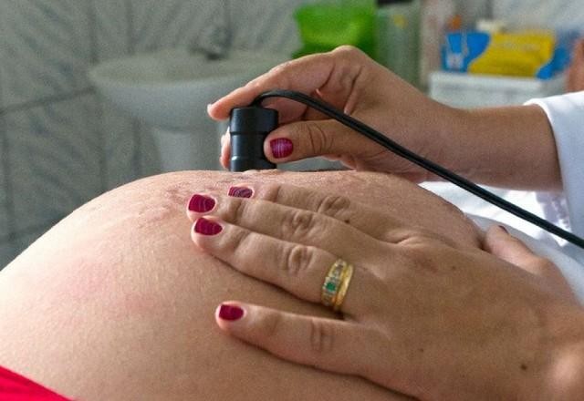 Imagem da noticia Número de cesáreas voltou a subir no Brasil em 2022