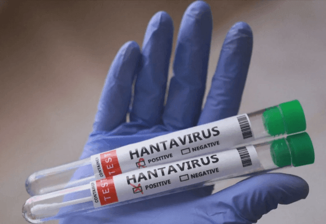Imagem da noticia Rio Grande do Sul registra dois casos de hantavirose em 2026; um paciente morreu
