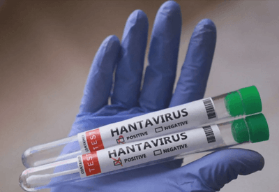 Rio Grande do Sul registra dois casos de hantavirose em 2026; um paciente morreu