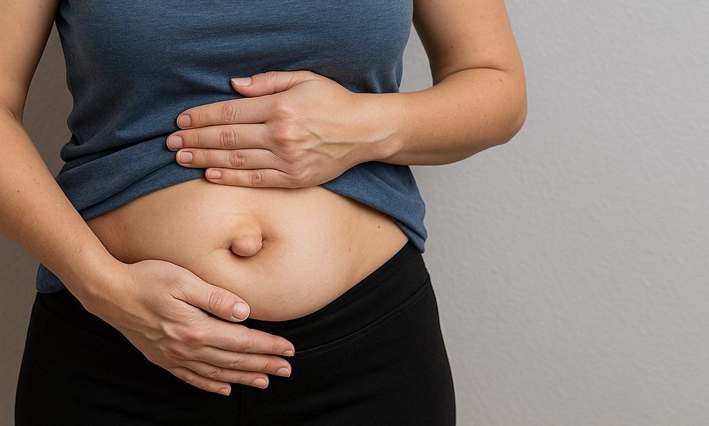 Imagem da noticia Hérnia umbilical: o que é, por que aparece e quando operar
