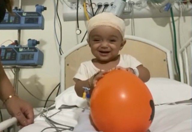 Imagem da noticia Cirurgia inovadora transforma o tratamento de bebês com hidrocefalia