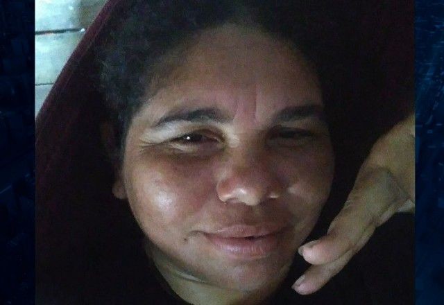 Mulher dá entrada em hospital para cirurgia na clavícula e sai sem o útero