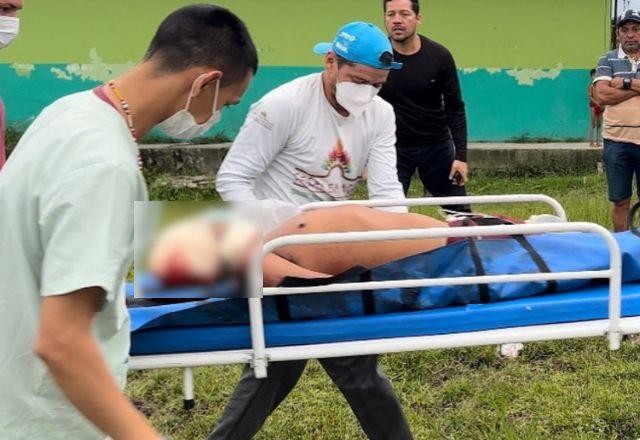 Imagem da noticia Três yanomamis são baleados por garimpeiros, diz liderança indígena