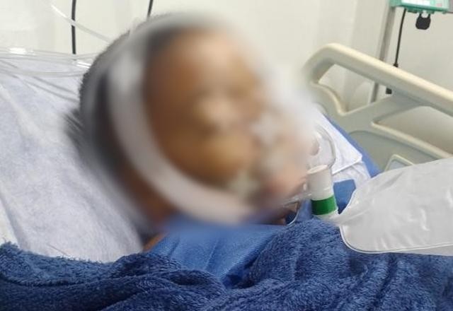 Imagem da noticia RJ: Menino de 9 anos sofre corte profundo na perna ao ser atingido por linha chilena