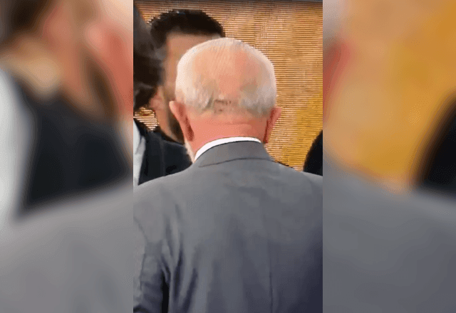 Imagem da noticia Vídeo: veja como ficou ferimento de Lula após queda em banheiro