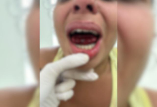 Imagem da noticia Homem é preso por morder a língua da ex-companheira