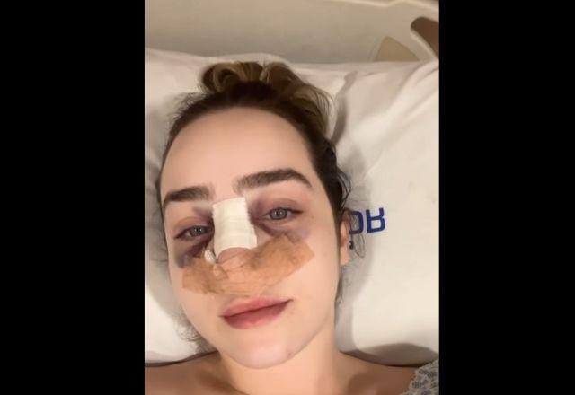 Imagem da noticia Mulher é agredida com cabeçada e socos por desconhecido no ABC Paulista