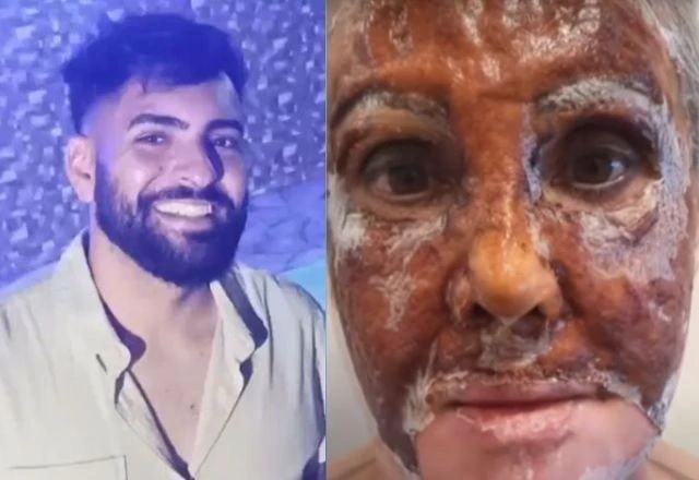 Imagem da noticia Apesar de oferecer riscos, fenol é facilmente encontrado à venda na internet