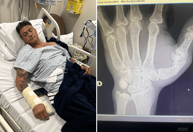 Imagem da noticia Popó anuncia cirurgia após briga generalizada em luta com Wanderlei Silva