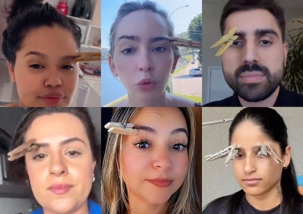 Imagem da noticia Entenda por que "truque do pregador na sobrancelha" não resolve enxaqueca