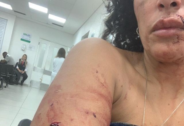 Imagem da noticia Confusão em bar de São Paulo termina em agressão com garrafada na cabeça  