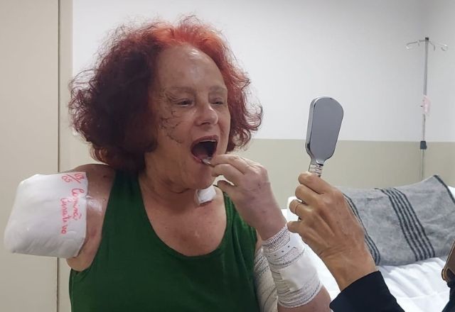 Imagem da noticia Roseana Murray: Justiça torna réus responsáveis por pitbulls