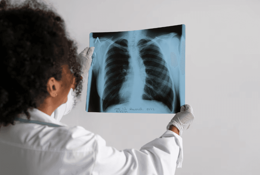 Imagem da noticia Por que jovens negros são os que mais abandonam o tratamento contra a tuberculose? Entenda 