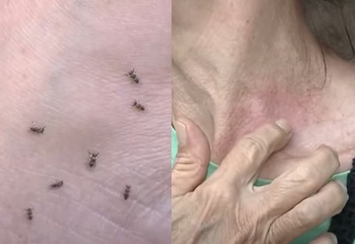 Surto de borrachudos: infestação preocupa população e comerciantes no Rio de Janeiro