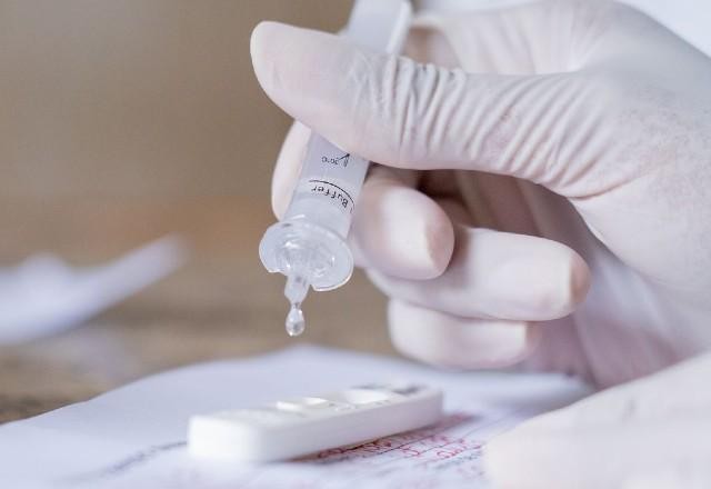 Imagem da noticia Brasil registra 61.870 casos e 578 mortes por covid-19 em 24 horas
