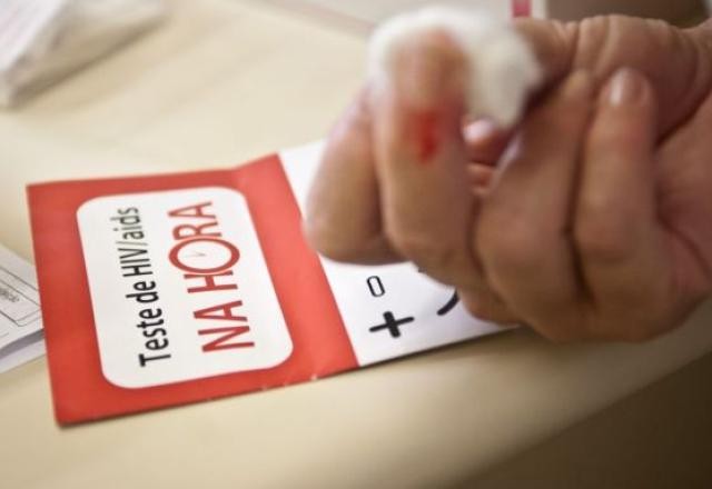 Imagem da noticia AIDS: a epidemia dentro da pandemia da covid chega a 2022