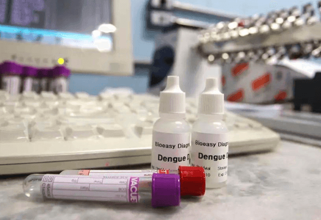 Imagem da noticia Anvisa vai priorizar registro de equipamentos para diagnóstico da dengue